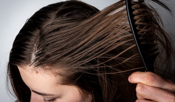 Oily Scalp: Why You Have It And How To Prevent It | Nizoral