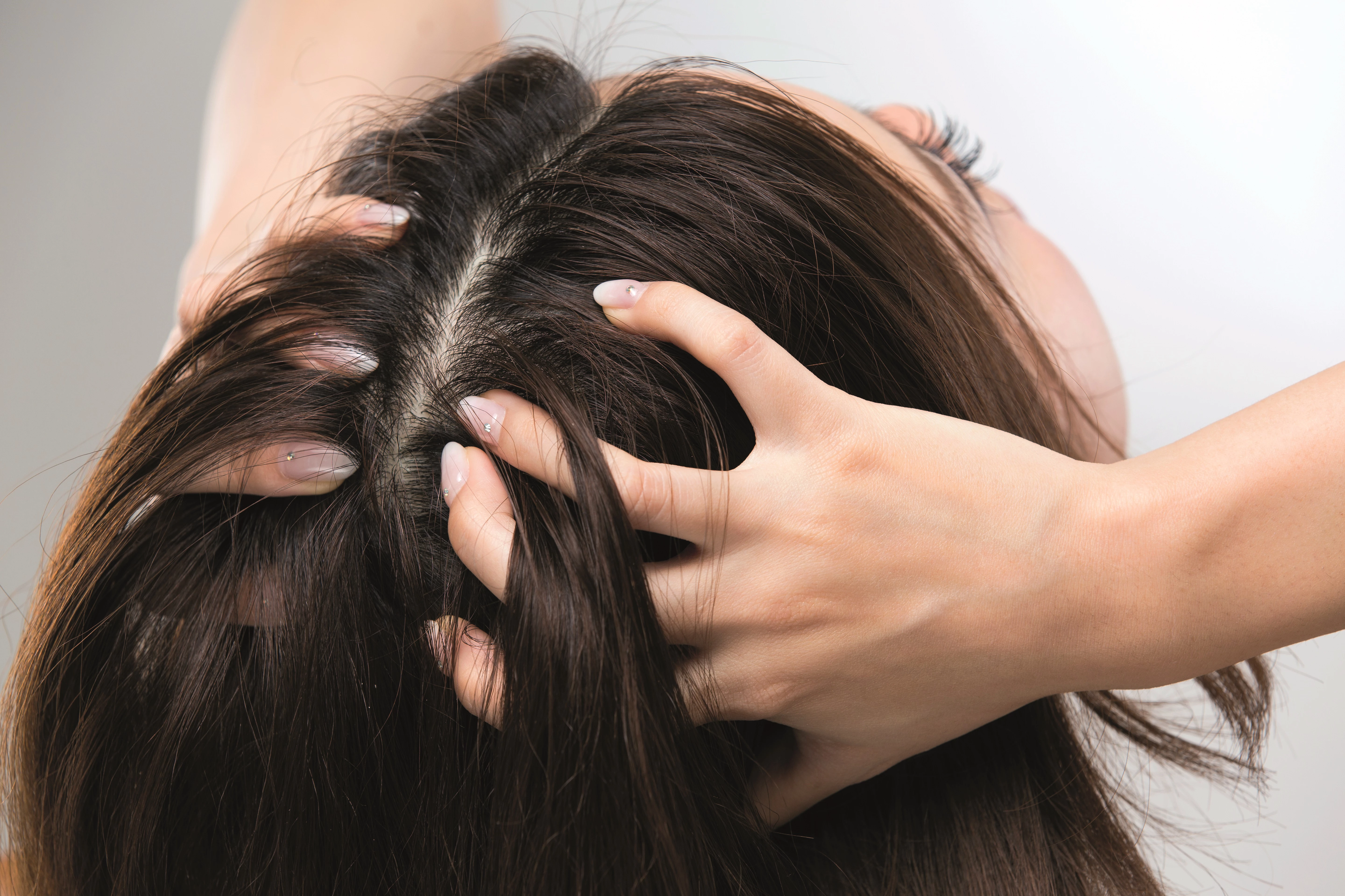 Scalp Tenderness - What's Causing It? | Nizoral